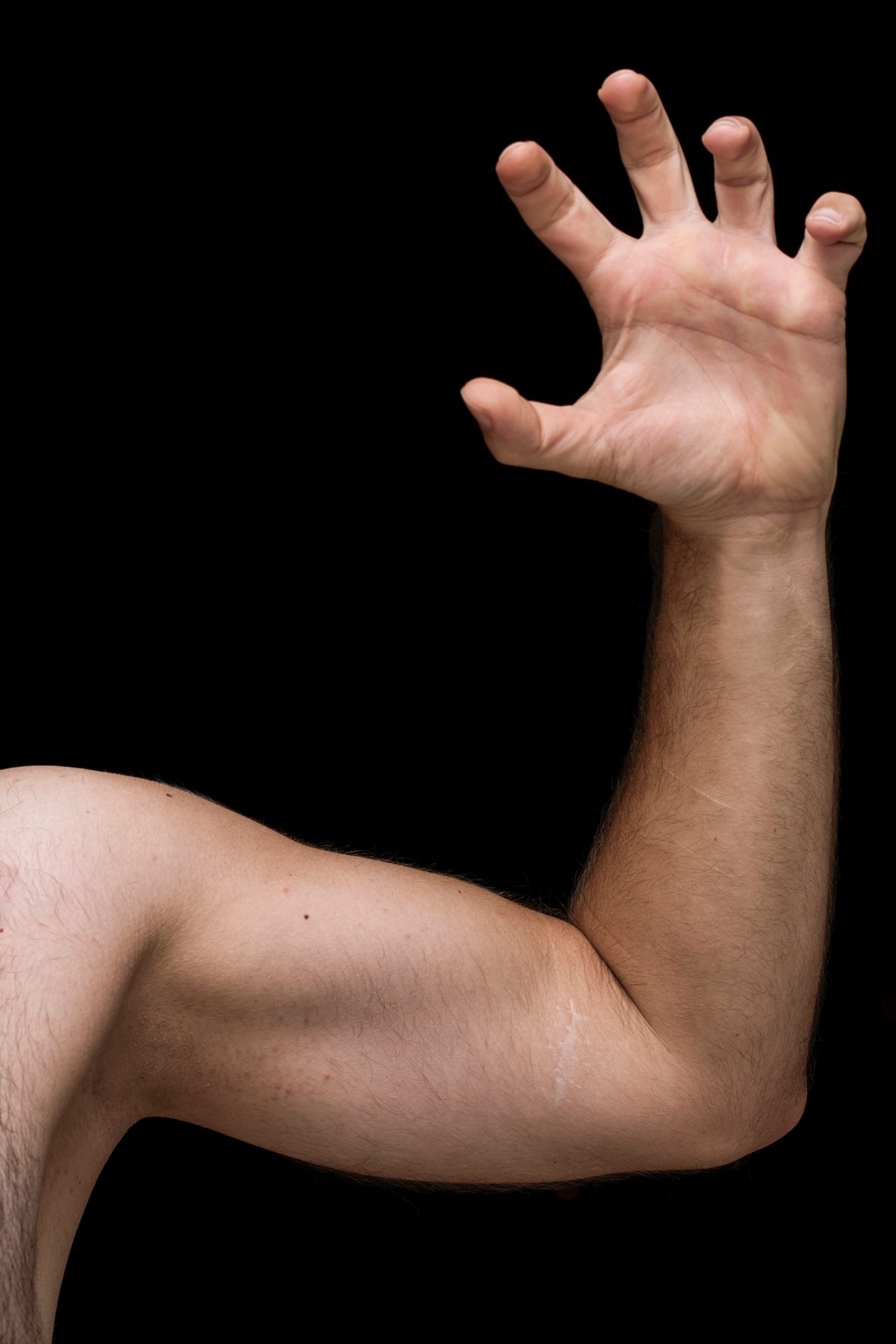 Elbow Injuries